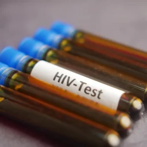 HIV Test