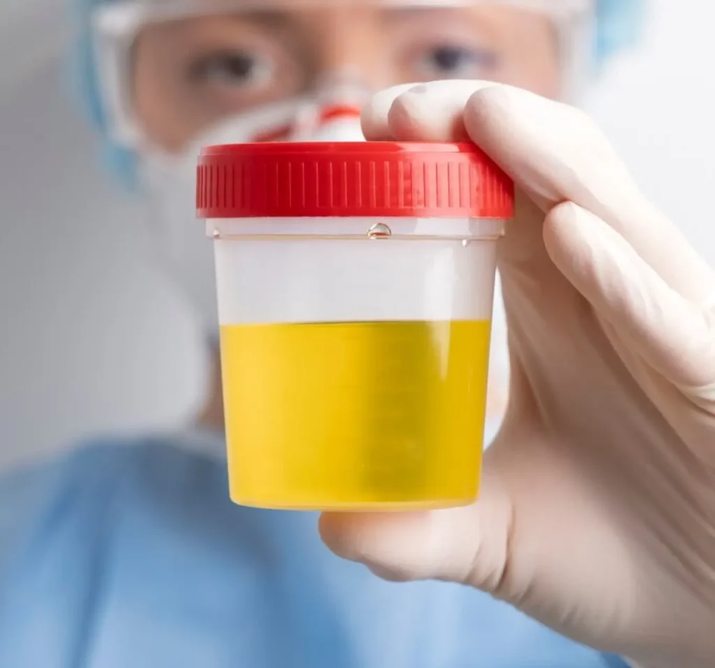 5 Panel Urine Drug Test in Chicago