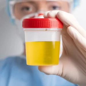 5 Panel Urine Drug Test in Chicago