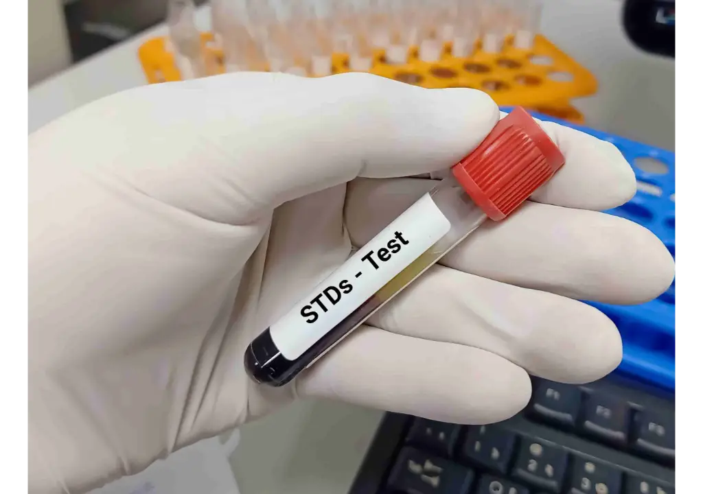 biochemist-lab-technologist-holds-blood-sample-stds-test-with-laboratory-background-1-1-scaled