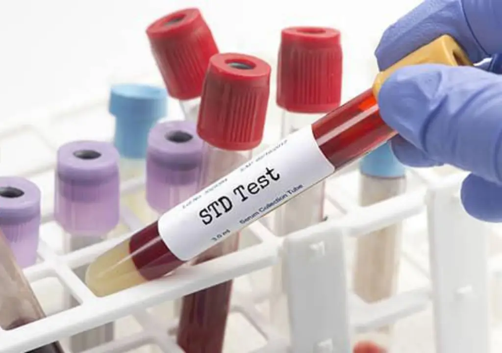 Repeat STD Testing After Treatment