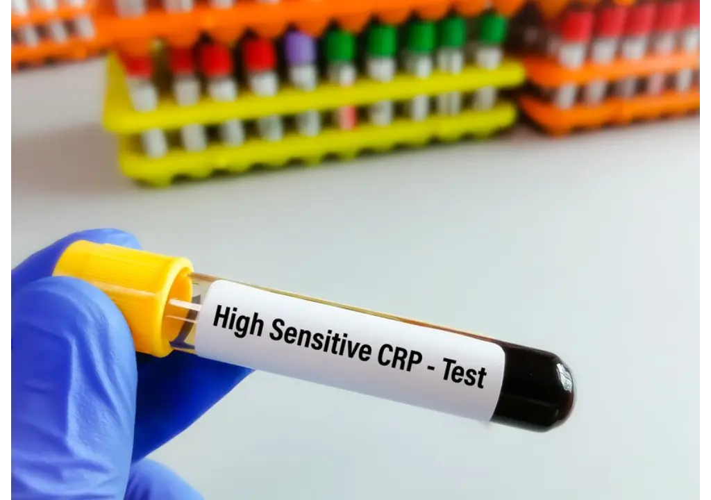 High-Sensitivity CRP Test