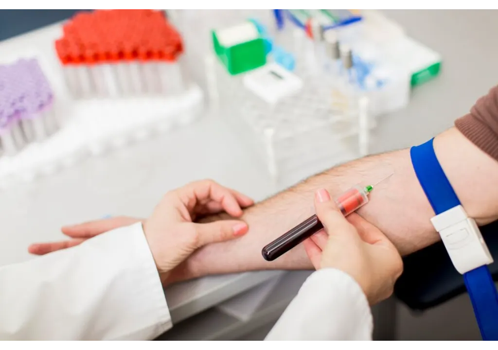 Top Benefits of Getting a General Health Panel Blood Test